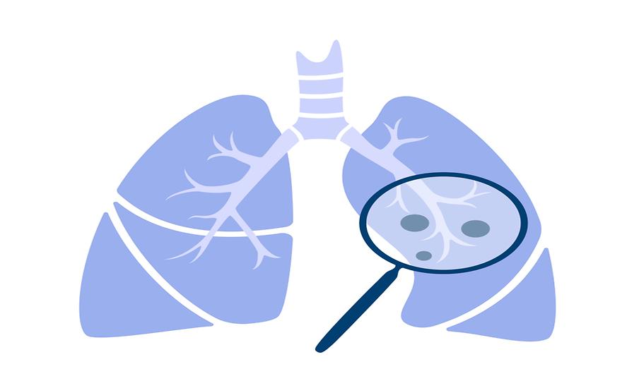 약학과 김정현 교수팀, 폐 면역체계 재현 ‘폐 어셈블로이드’ 개발